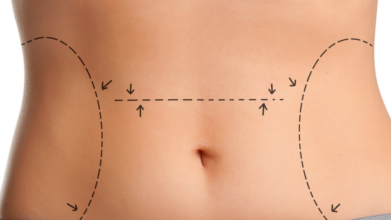 Liposuction in Jaipur