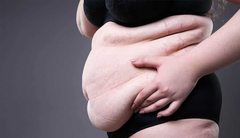 Post Weight Loss Body Contouring in Jaipur