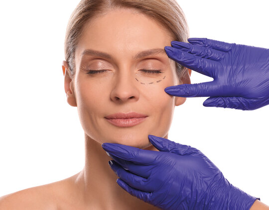 Blepharoplasty in Jaipur