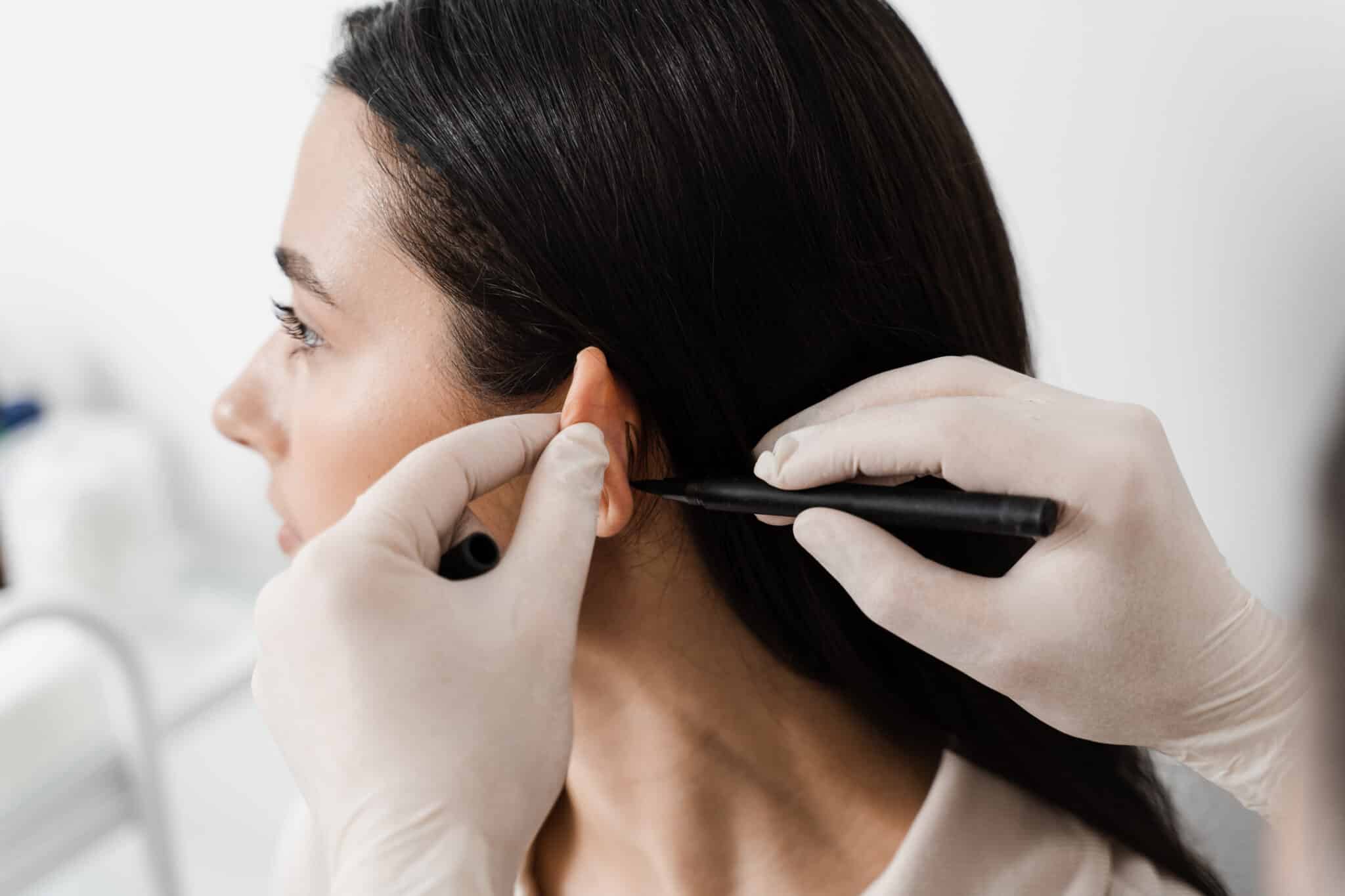 Otoplasty in Jaipur