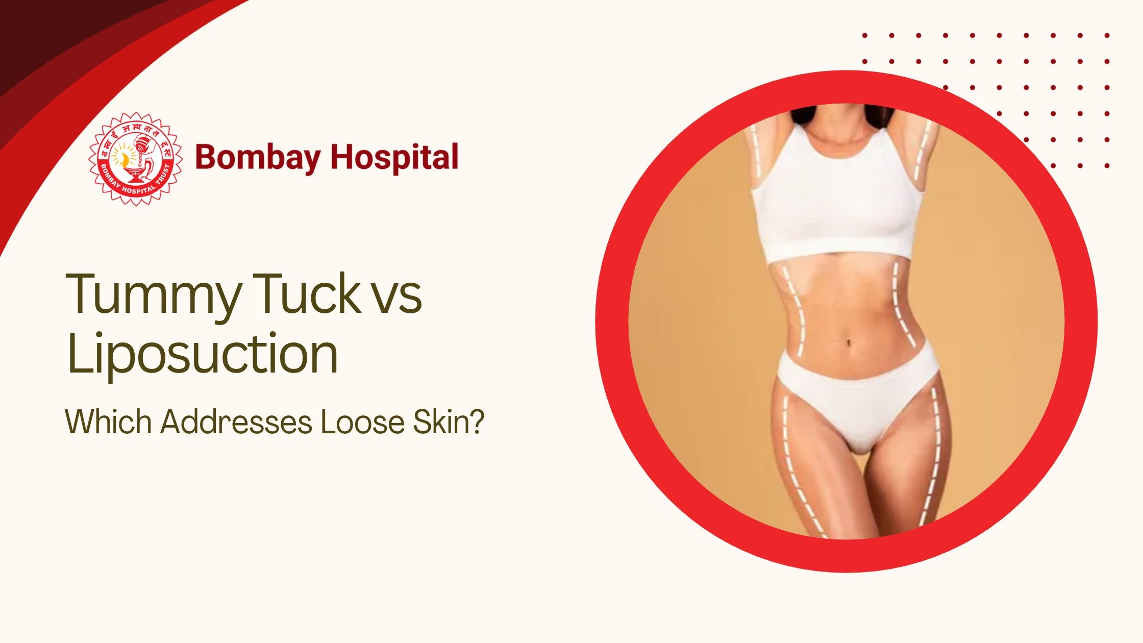 Tummy Tuck vs Liposuction: Which Addresses Loose Skin?