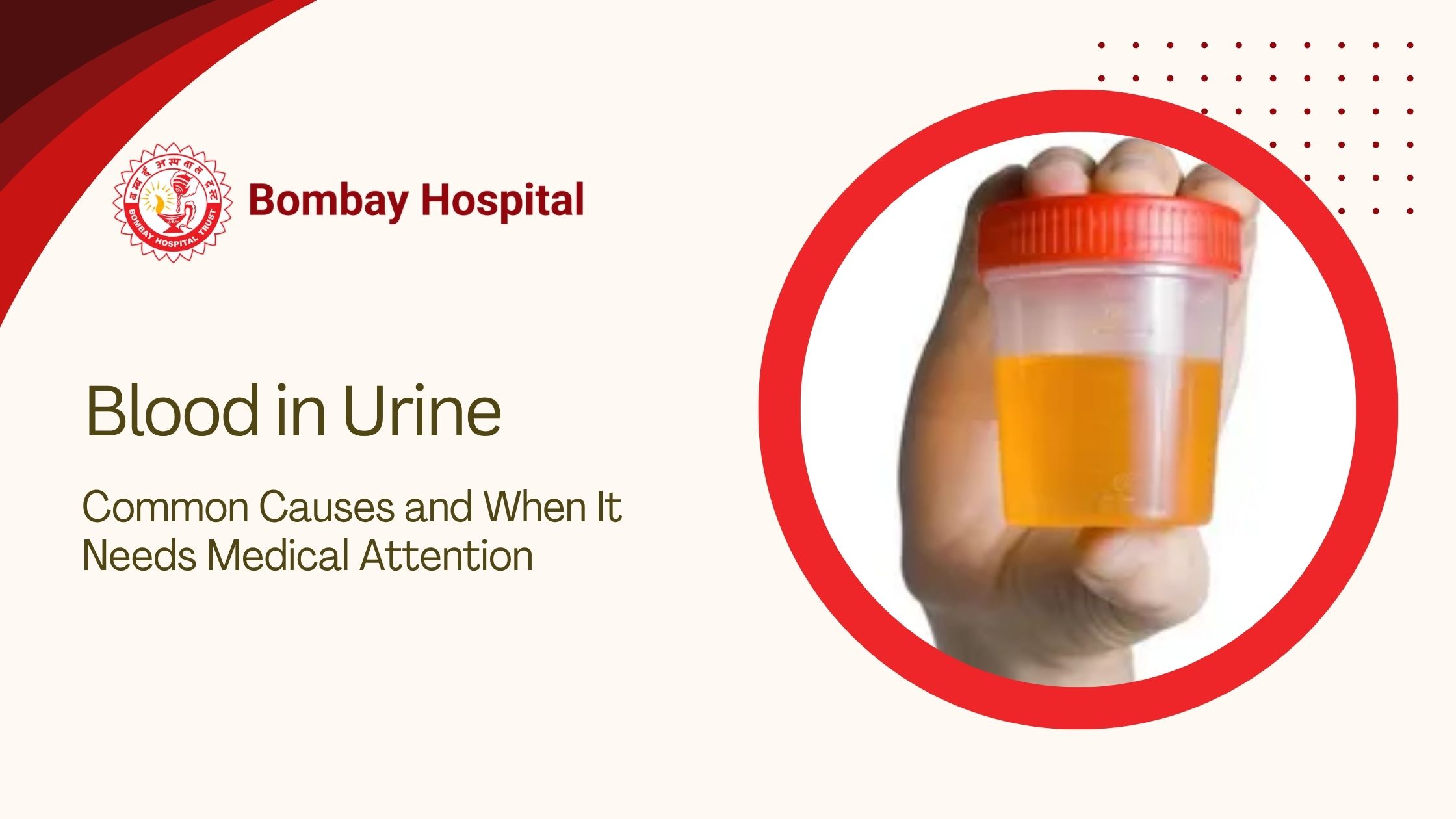 Blood in Urine: Common Causes and When It Needs Medical Attention